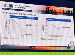 春&ミラディ/NOIR SP PSA10 春&ミラディ/NOIR SP PSA10 ヴァイス